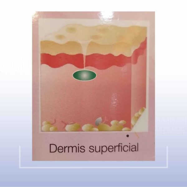 Revofil Fine Soft Touch Filler - Image 3